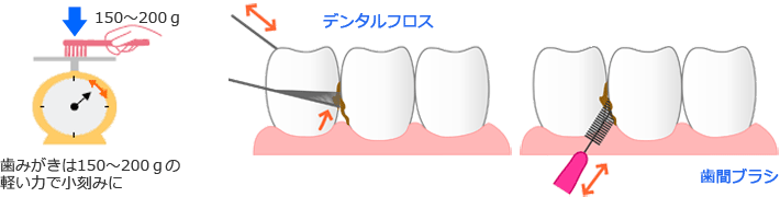 ＴＢＩ（歯磨き指導）