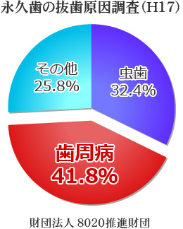 永久歯の抜歯原因調査 ― 歯周病が原因で歯科医院で歯を失った方の調査結果