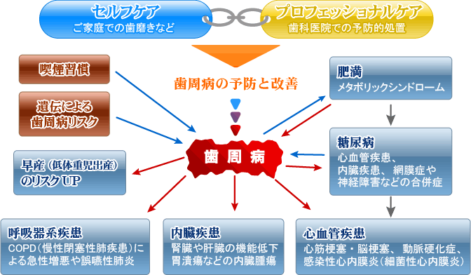 歯周病の予防と改善